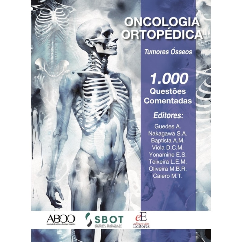 ONCOLOGIA ORTOPÉDICA TUMORES ÓSSEOS: 1.000 QUESTÕES COMENTADAS