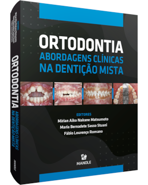 Ortodontia: abordagens clínicas na dentição mista