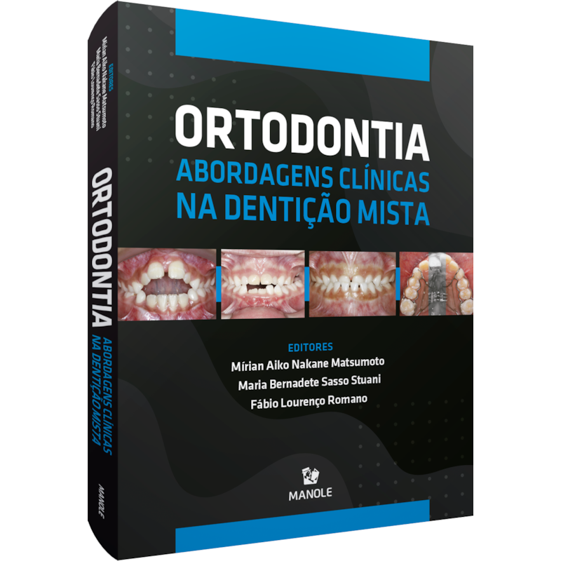 ORTODONTIA: ABORDAGENS CLÍNICAS NA DENTIÇÃO MISTA