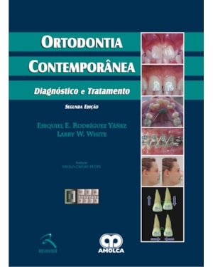 Ortodontia contemporânea: diagnóstico e tratamento