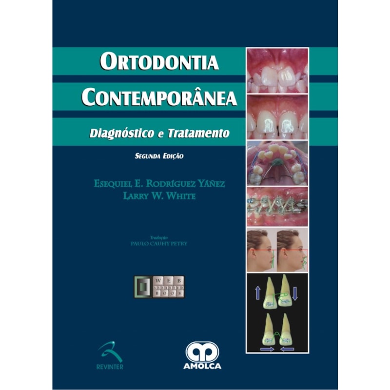 ORTODONTIA CONTEMPORÂNEA: DIAGNÓSTICO E TRATAMENTO
