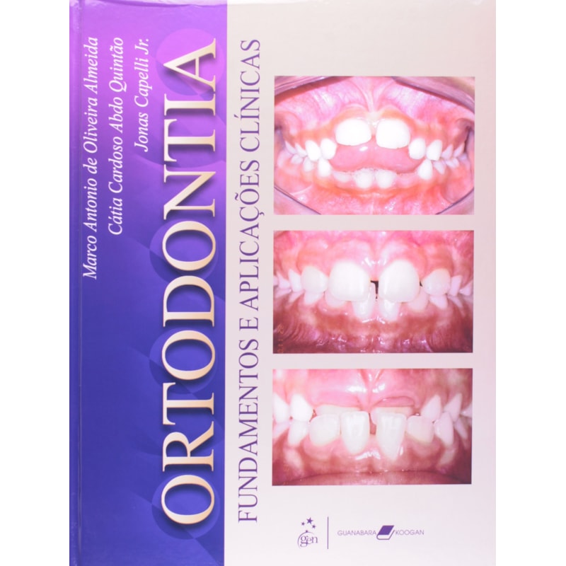 ORTODONTIA FUNDAMENTOS E APLICAÇÕES CLÍNICAS