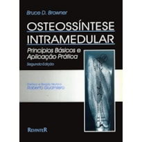 OSTEOSSÍNTESE INTRAMEDULAR