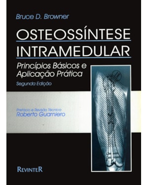 OSTEOSSÍNTESE INTRAMEDULAR
