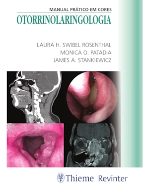 Otorrinolaringologia: manual prático em cores
