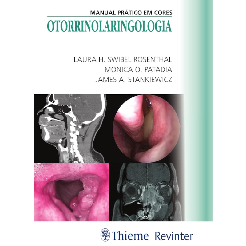 OTORRINOLARINGOLOGIA: MANUAL PRÁTICO EM CORES