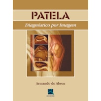 PATELA: DIAGNÓSTICO POR IMAGEM