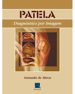 PATELA: DIAGNÓSTICO POR IMAGEM