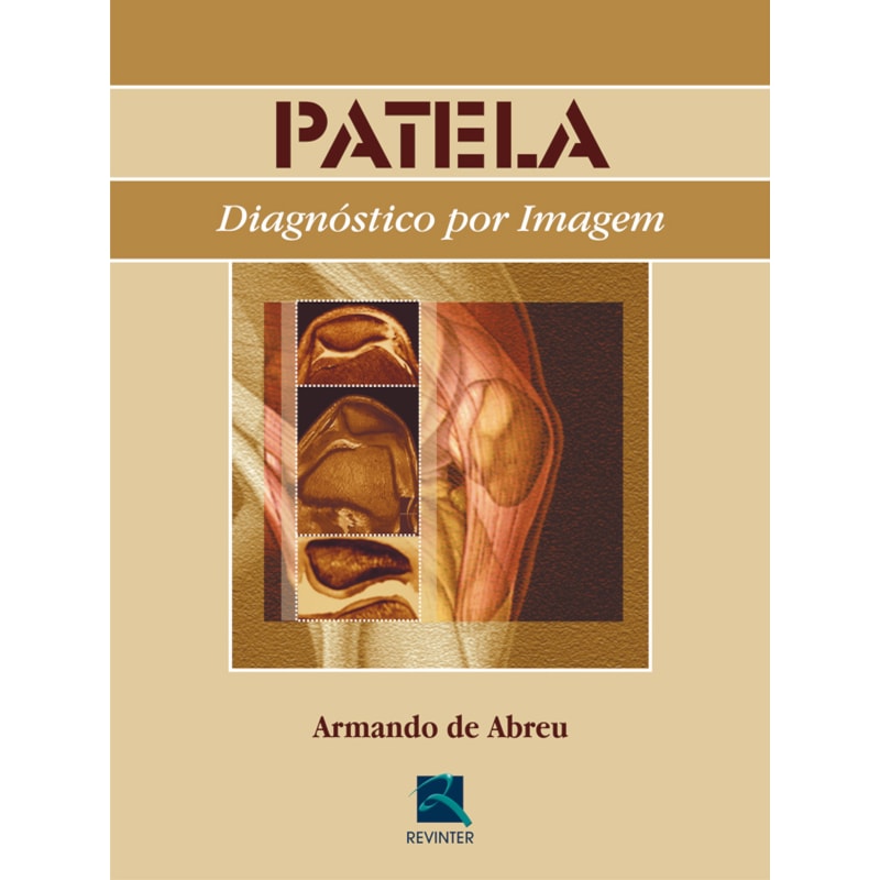 PATELA: DIAGNÓSTICO POR IMAGEM