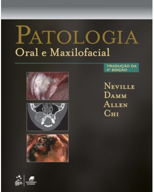 PATOLOGIA ORAL E MAXILOFACIAL
