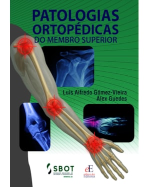 PATOLOGIAS ORTOPÉDICAS DO MEMBRO SUPERIOR