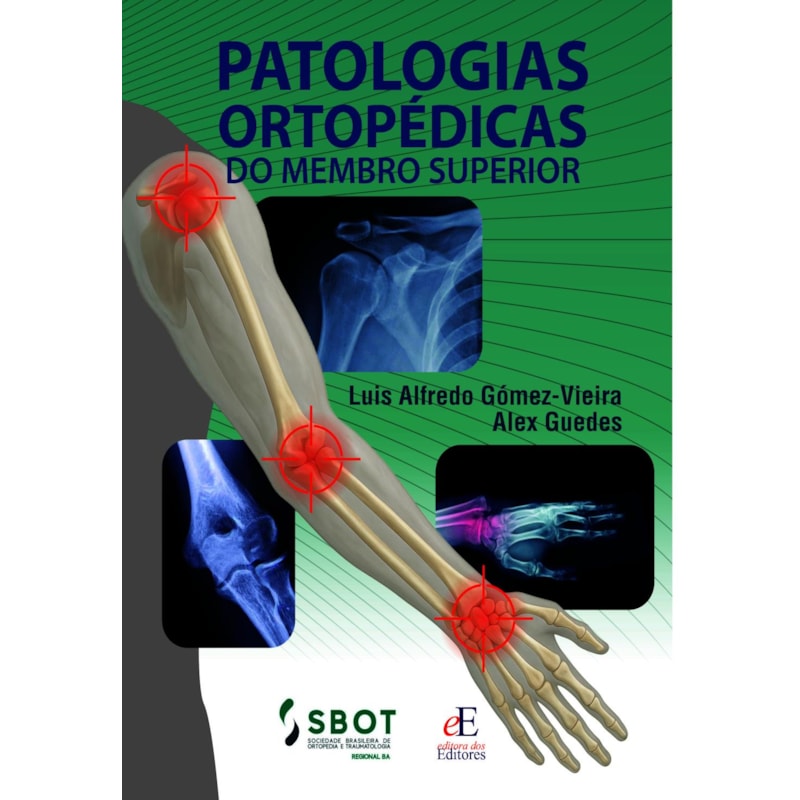 PATOLOGIAS ORTOPÉDICAS DO MEMBRO SUPERIOR