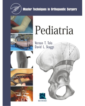 Pediatria: master techniques in orthopaedic surgery