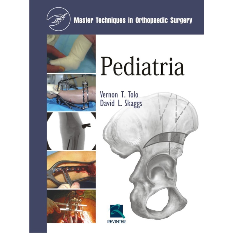 PEDIATRIA: MASTER TECHNIQUES IN ORTHOPEDIC SURGERY
