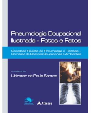 Pneumologia ocupacional ilustrada: fotos e fatos