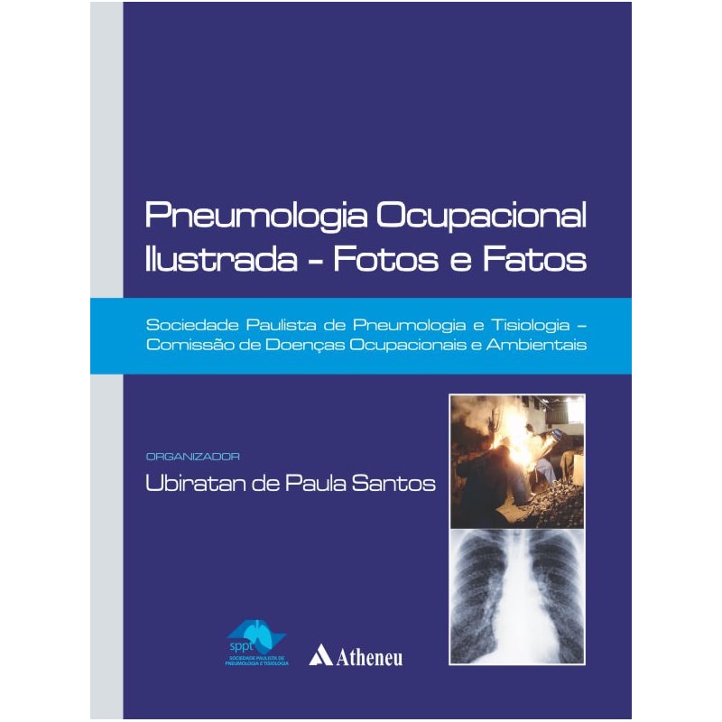 PNEUMOLOGIA OCUPACIONAL ILUSTRADA - FOTOS E FATOS