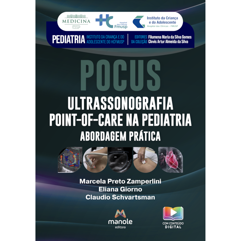 Pocus - Ultrassonografia point-of-care: Abordagem prática