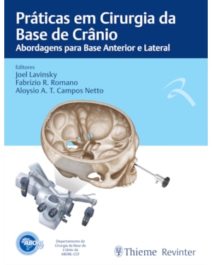 Práticas em cirurgia da base de crânio: abordagens para base anterior e lateral