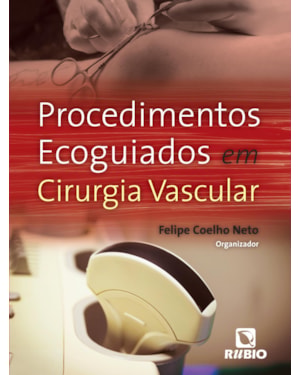 Procedimentos ecoguiados em cirurgia vascular