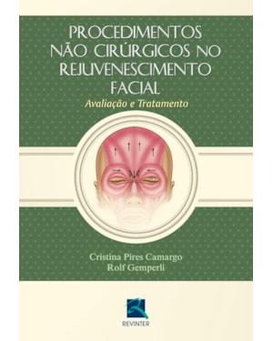 Procedimentos não cirúrgicos no rejuvenescimento facial: avaliação e tratamento