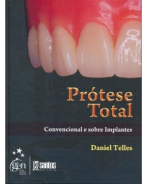 PRÓTESE TOTAL - CONVENCIONAL E SOBRE IMPLANTES