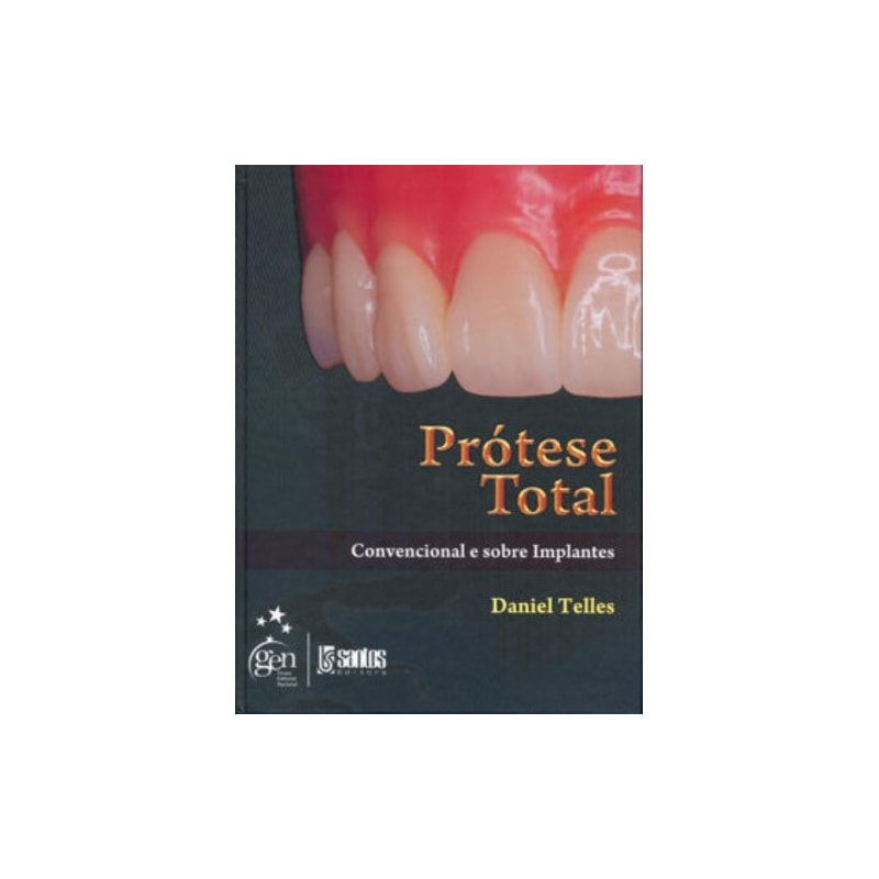 PRÓTESE TOTAL - CONVENCIONAL E SOBRE IMPLANTES