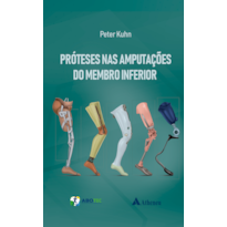 PRÓTESES NAS AMPUTAÇÕES DO MEMBRO INFERIOR