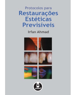 PROTOCOLOS PARA RESTAURAÇÕES ESTÉTICAS PREVISÍVEIS