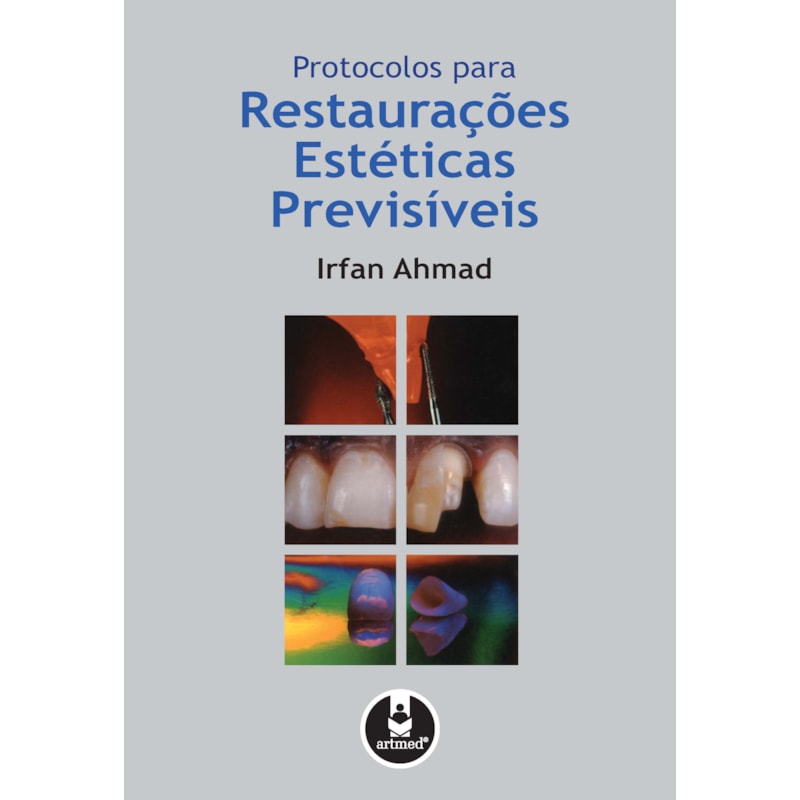 PROTOCOLOS PARA RESTAURAÇÕES ESTÉTICAS PREVISÍVEIS