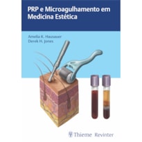 PRP E MICROAGULHAMENTO EM MEDICINA ESTÉTICA
