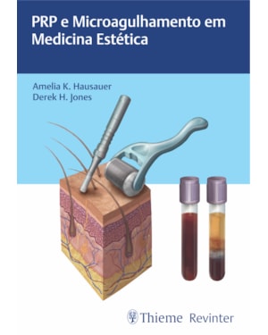 PRP e microagulhamento em medicina estética
