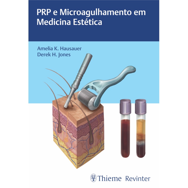 PRP E MICROAGULHAMENTO EM MEDICINA ESTÉTICA