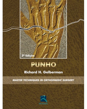 PUNHO: MASTER TECHNIQUES IN ORTHOPAEDIC SURGERY