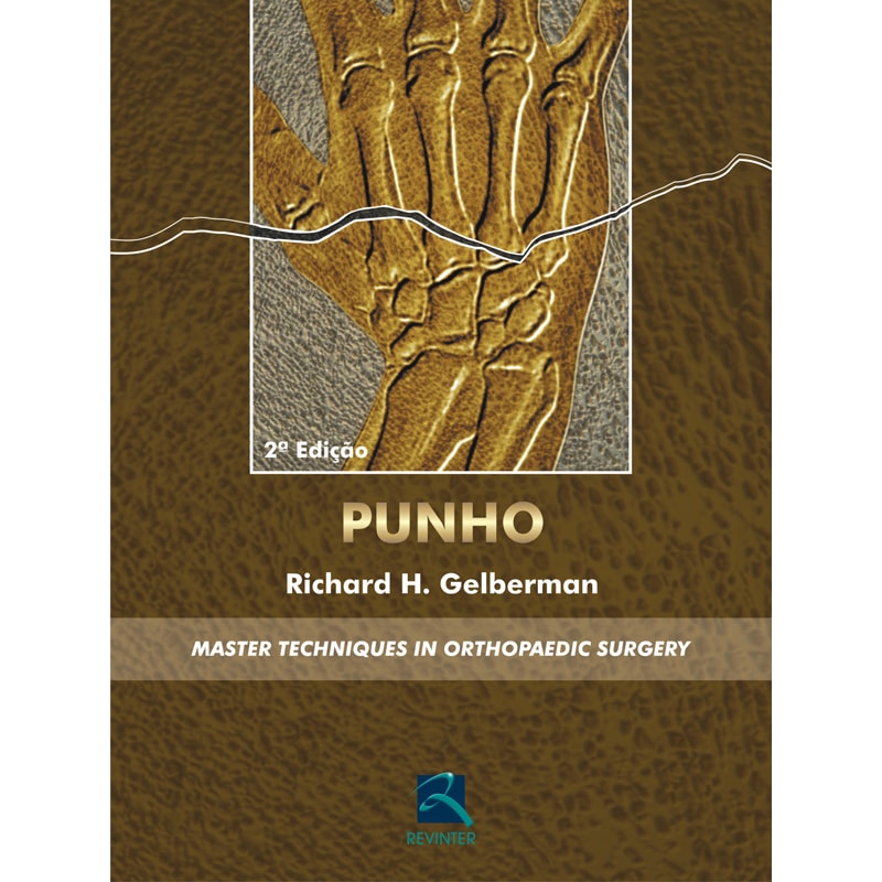 PUNHO: MASTER TECHNIQUES IN ORTHOPAEDIC SURGERY