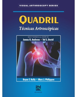Quadril: técnicas artroscópicas