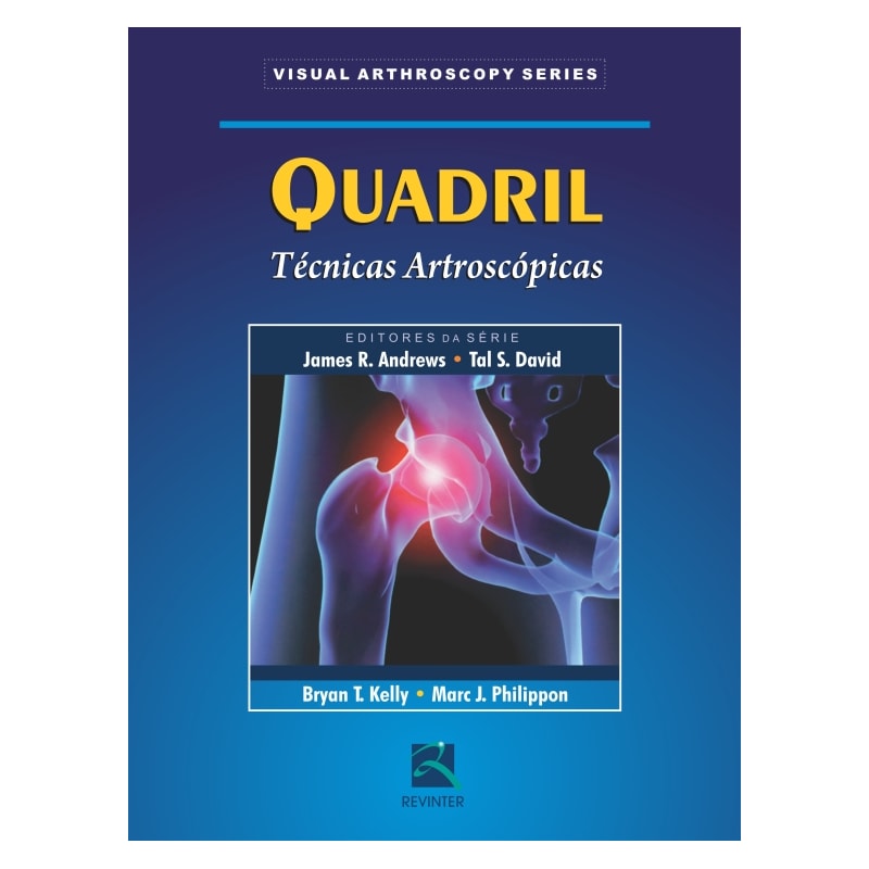 QUADRIL: TÉCNICAS ARTROSCÓPICAS