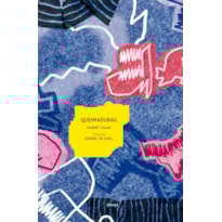 QUEIMADURAS QUEIMADURAS