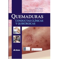 QUEMADURAS - CONDUCTAS CLINICAS Y QUIRURGICAS