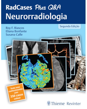 RadCases Plus Q&A - Neurorradiologia
