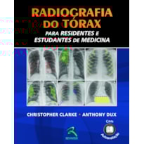 RADIOGRAFIA DO TÓRAX