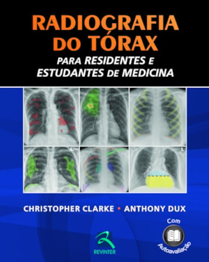 Radiografia do tórax para residentes e estudantes de medicina
