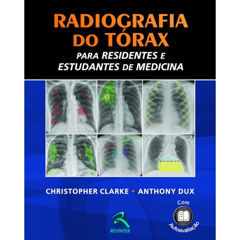 Radiografia do tórax para residentes e estudantes de medicina