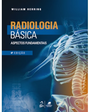 RADIOLOGIA BÁSICA - ASPECTOS FUNDAMENTAIS