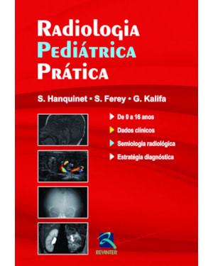Radiologia pediátrica prática
