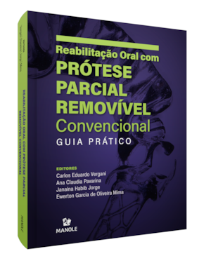 Reabilitação oral com prótese parcial removível convencional: guia prático