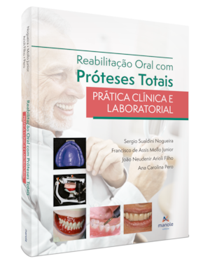 Reabilitação oral com próteses totais: prática clínica e laboratorial