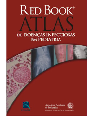 Red book - Atlas de doenças infecciosas em pediatria: casos clínicos