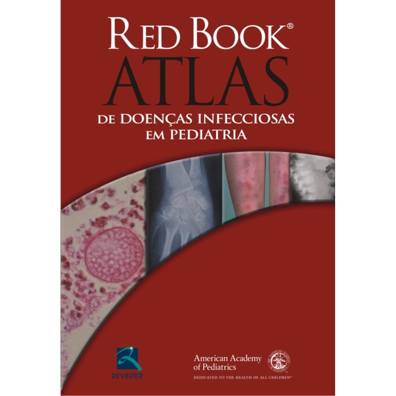 Red book - Atlas de doenças infecciosas em pediatria: casos clínicos
