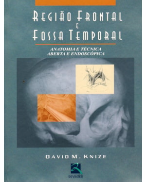 Região frontal e fossa temporal: anatomia e técnica aberta e endoscópica