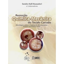 REMOÇÃO QUÍMICA E MECÂNICA DO TECIDO CARIADO